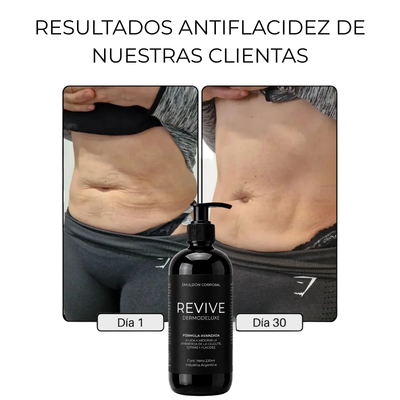 DERMODELUXE – Emulsión Corporal Anticelulitis, Antiflacidez y Efecto Drenante
