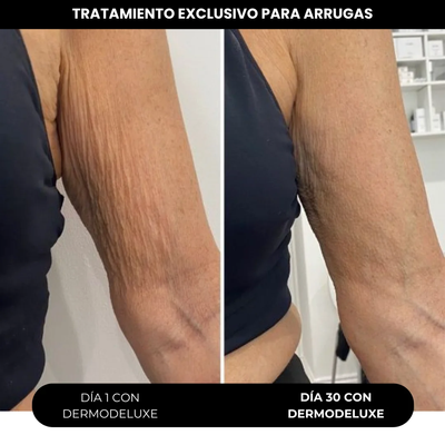 DERMODELUXE – Emulsión Corporal Anticelulitis, Antiflacidez y Efecto Drenante