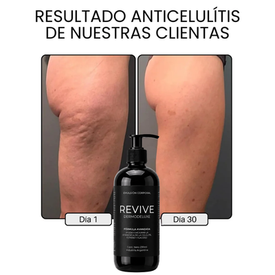 DERMODELUXE – Emulsión Corporal Anticelulitis, Antiflacidez y Efecto Drenante
