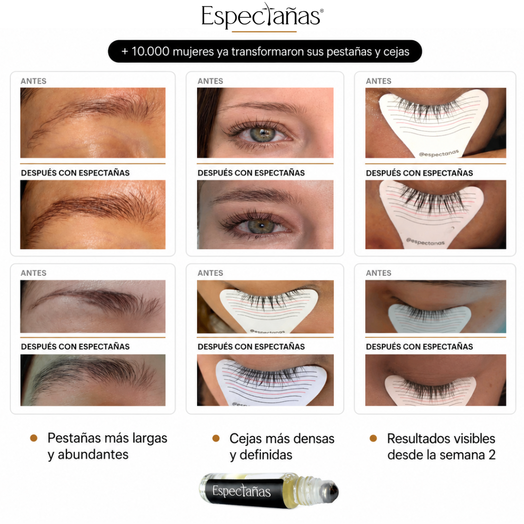 Espectañas® — Tratamiento Natural Activador de Crecimiento para Pestañas y Cejas