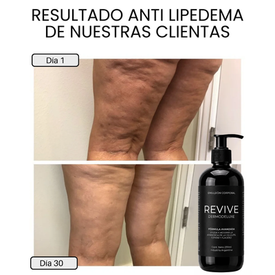 DERMODELUXE – Emulsión Corporal Anticelulitis, Antiflacidez y Efecto Drenante