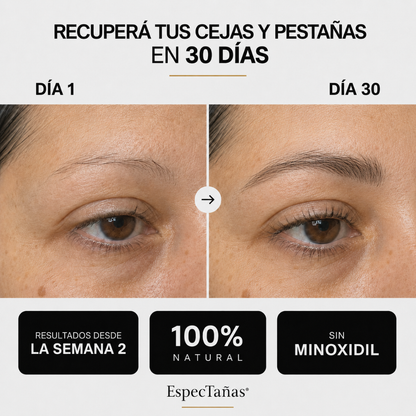 Espectañas® — Tratamiento Natural Activador de Crecimiento para Pestañas y Cejas