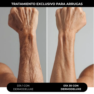 DERMODELUXE – Emulsión Corporal Anticelulitis, Antiflacidez y Efecto Drenante