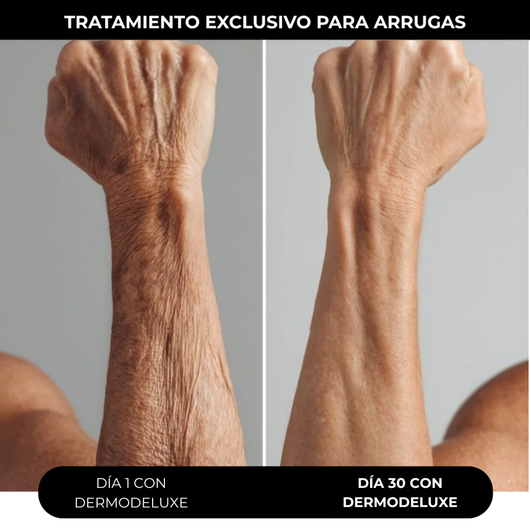 DERMODELUXE – Emulsión Corporal Anticelulitis, Antiflacidez y Efecto Drenante